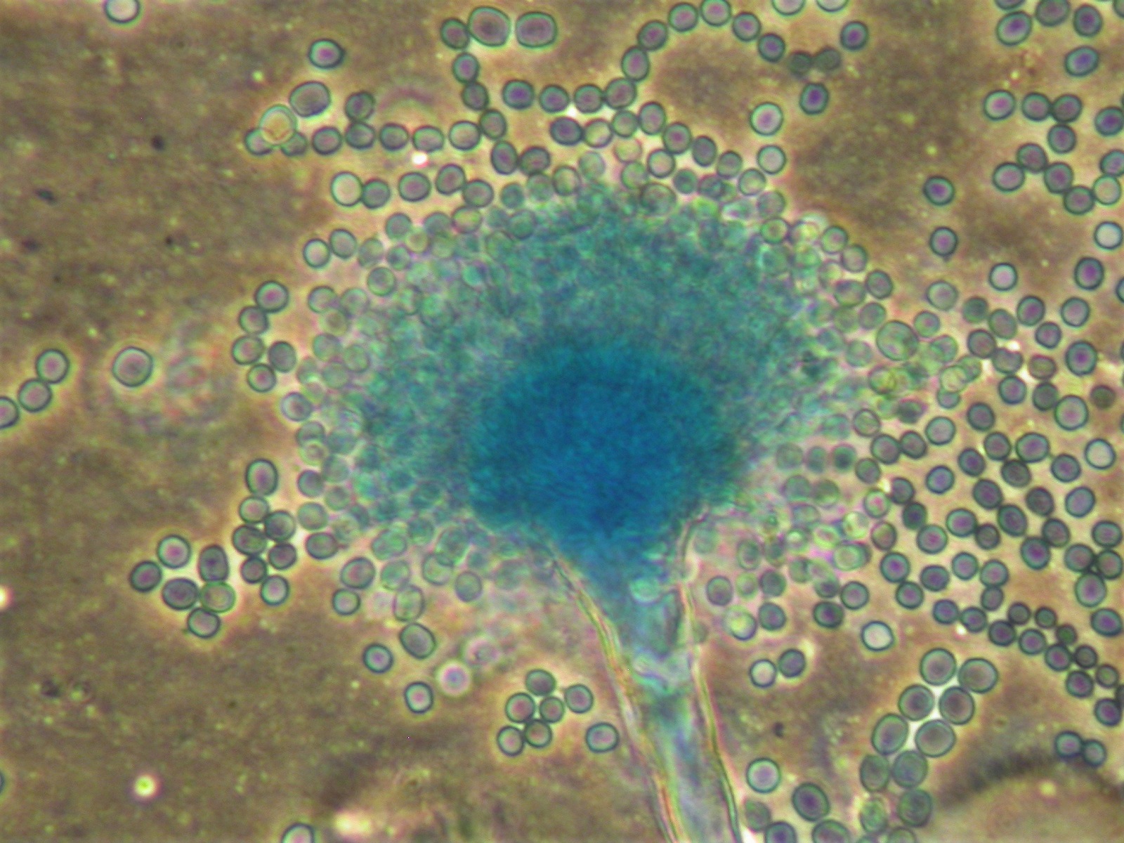 Aspargillus Flavus